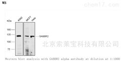 K106888PAnti-GABBR2 Polyclonal Antibody