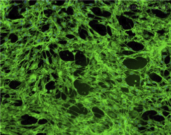 HGnF；人牙齦成纖維細(xì)胞（原代細(xì)胞）